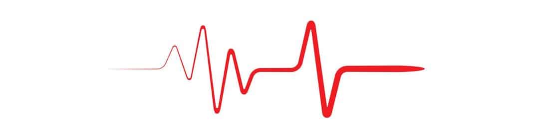 Employee Pulse Survey. Measure pulse of your organization.